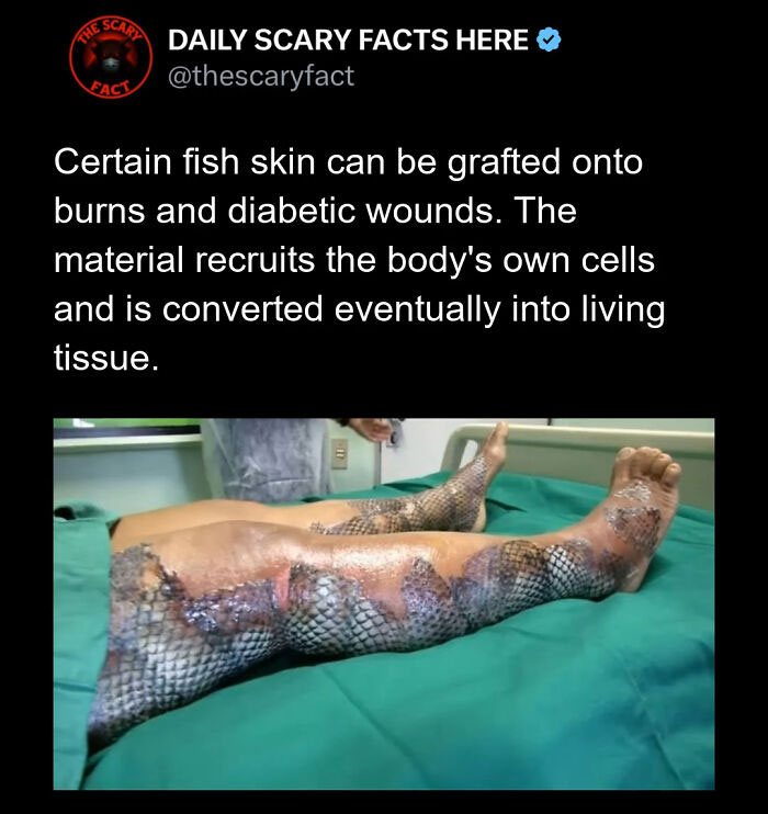 Hold Up—83 Shocking Real-Life Stories That'll Totally Blow Your Mind