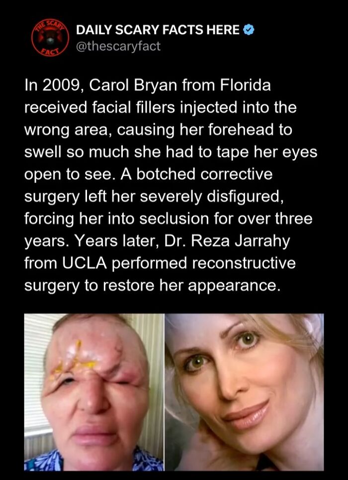 Hold Up—83 Shocking Real-Life Stories That'll Totally Blow Your Mind