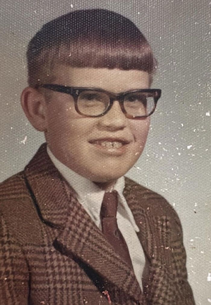 My Husband’s Bangs Hid a ‘Growing’ Forehead