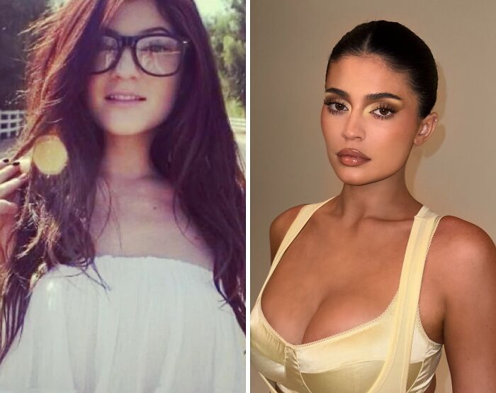 Kylie Jenner’s Lip Filler Cover-Up