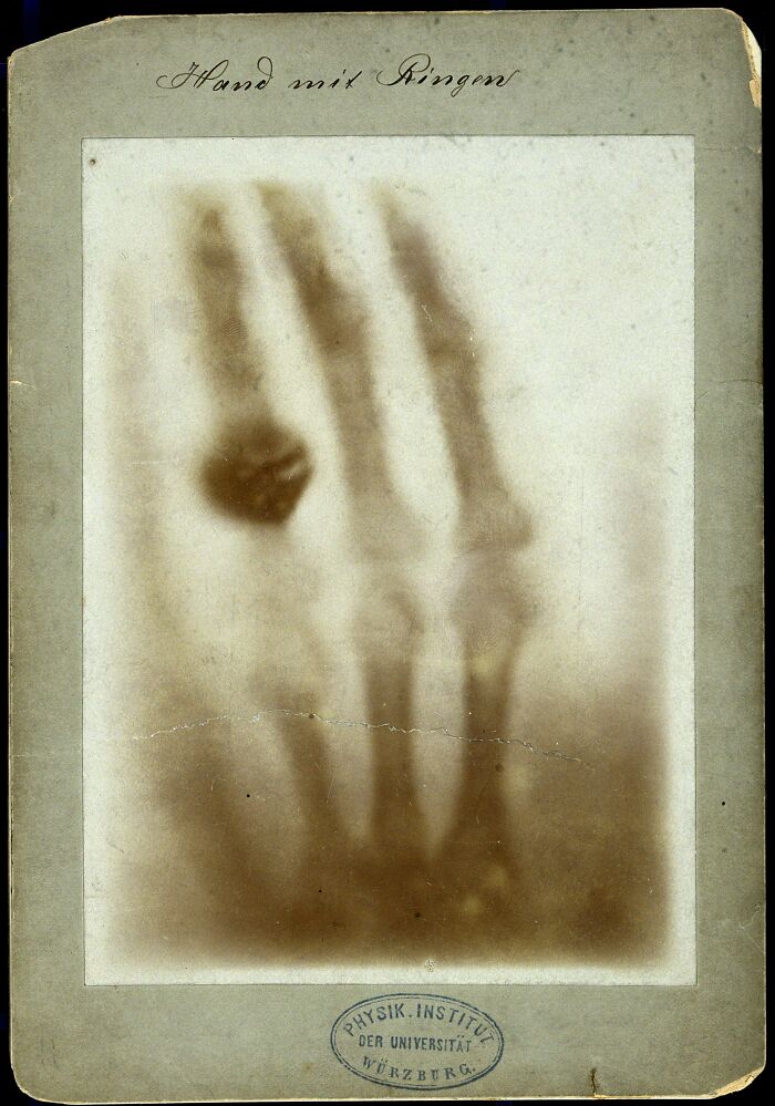 First Ever X-Ray Image: A Hand Wearing Rings, 1895