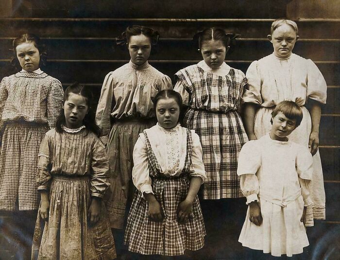 Girls With Down Syndrome At A New York Institution, 1902