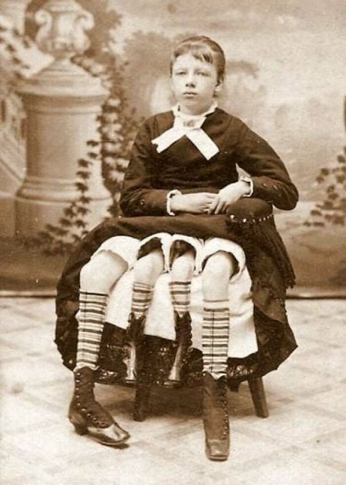 Myrtle Corbin, The Four-Legged Victorian Wonder Woman