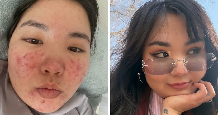 Wait, They Actually Changed That Much in 3 Years?!