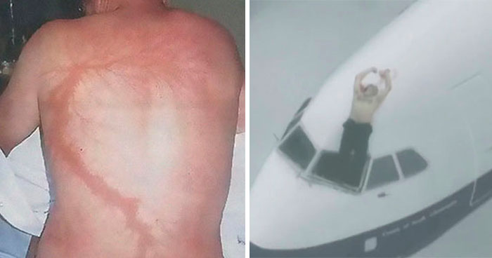 Wait, They Actually Survived THAT?! 49 Wild Human Comebacks From ‘No Way!’ to ‘Heck Yeah!’