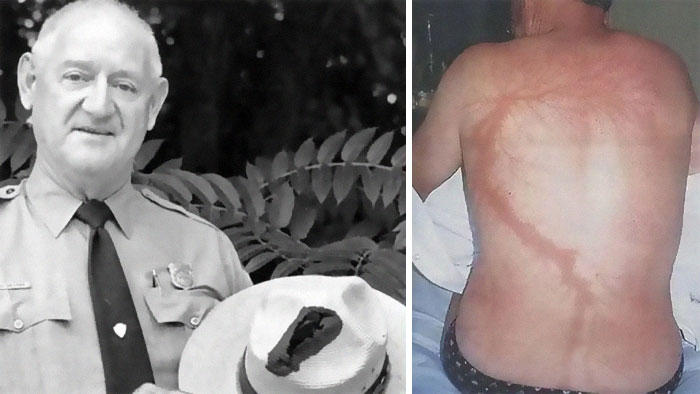 Wait, They Actually Survived THAT?! 49 Wild Human Comebacks From 'No Way!' to 'Heck Yeah!'