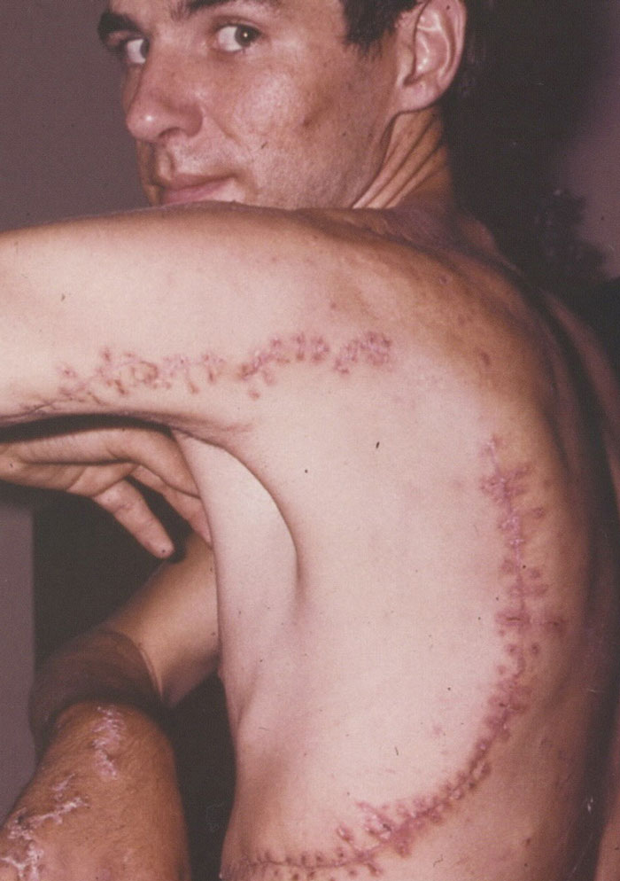 Wait, They Actually Survived THAT?! 49 Wild Human Comebacks From 'No Way!' to 'Heck Yeah!'