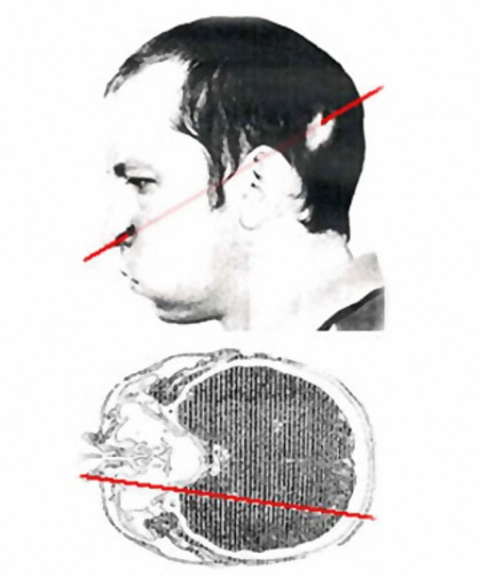 Wait, They Actually Survived THAT?! 49 Wild Human Comebacks From 'No Way!' to 'Heck Yeah!'