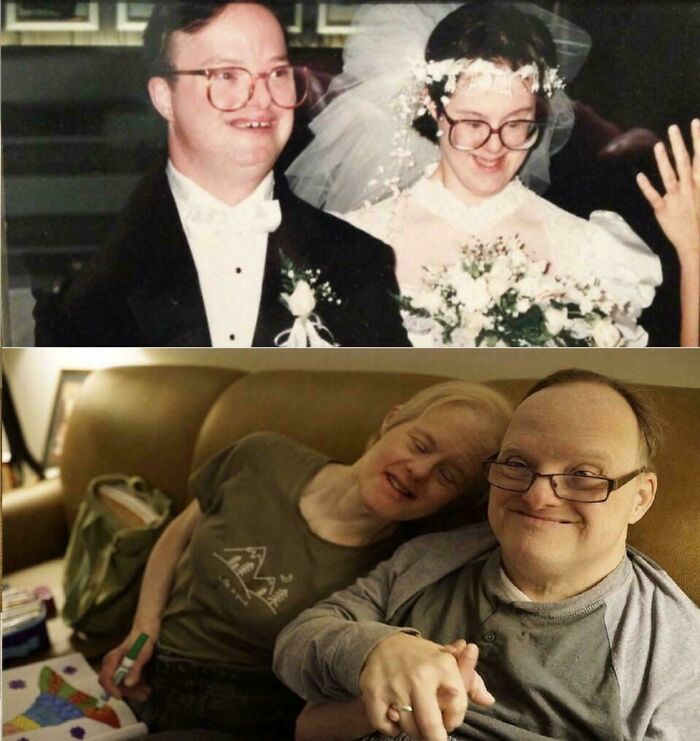 A Couple With Downs Syndrome Celebrates 25 Years Of Marriage, And It’s Beautiful