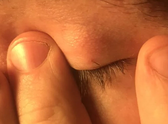 Wait, People Actually Talked About Their Weird Body Quirks?