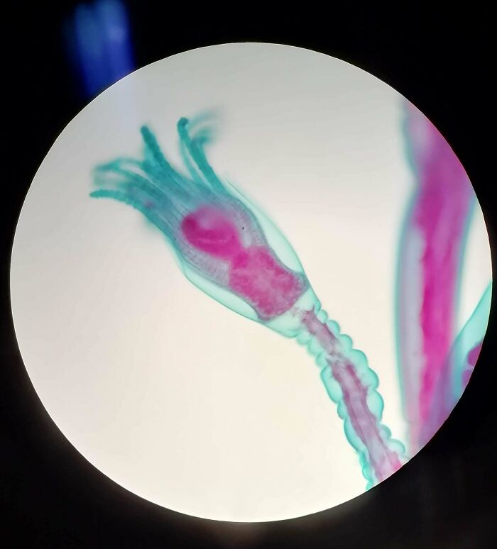 Whoa, These Crazy Close-Up Microscope Pics Will Blow Your Mind