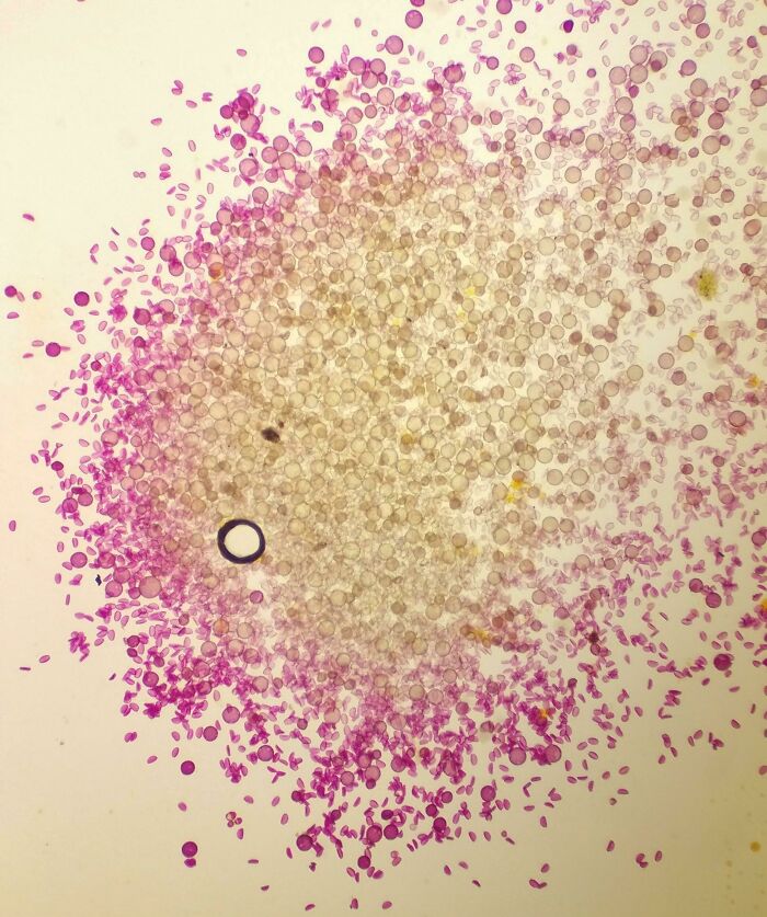 Whoa, These Crazy Close-Up Microscope Pics Will Blow Your Mind