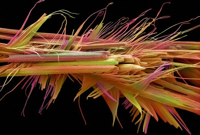 Whoa, These Crazy Close-Up Microscope Pics Will Blow Your Mind