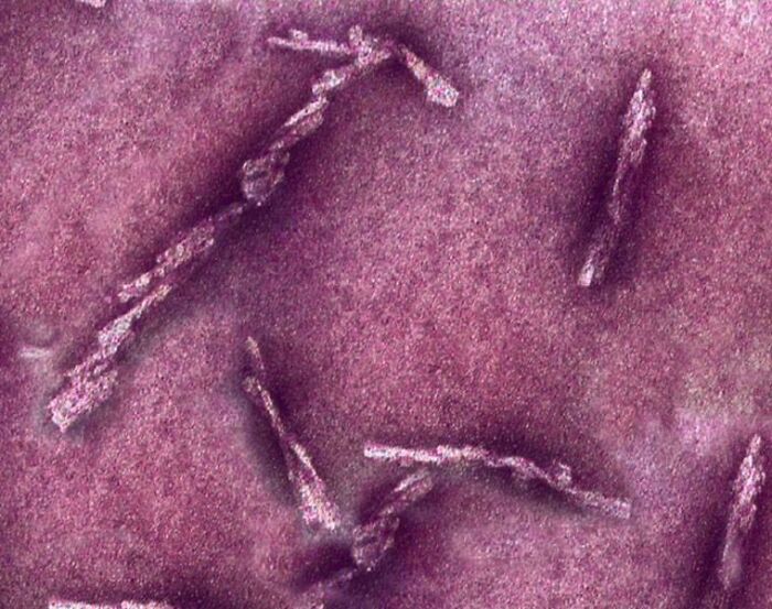 Whoa, These Crazy Close-Up Microscope Pics Will Blow Your Mind