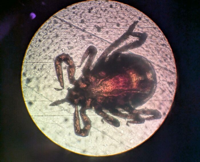 Whoa, These Crazy Close-Up Microscope Pics Will Blow Your Mind