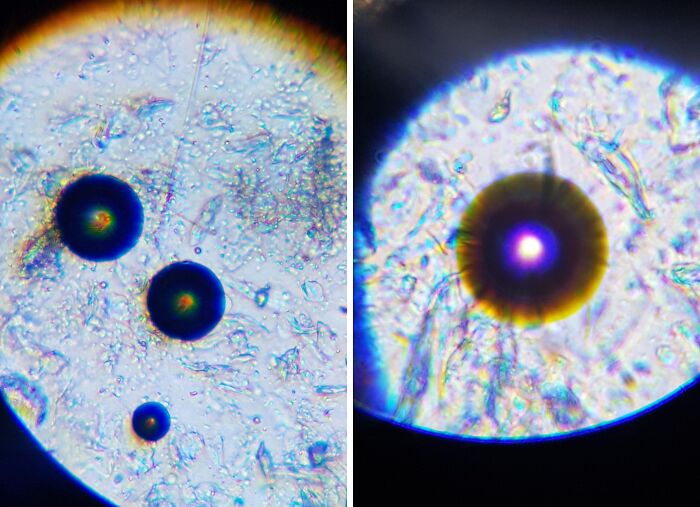 Whoa, These Crazy Close-Up Microscope Pics Will Blow Your Mind