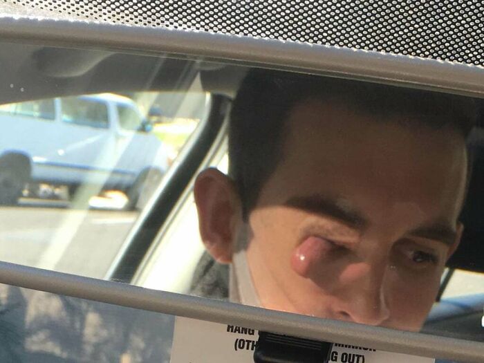 Hotdog With an Eye?!