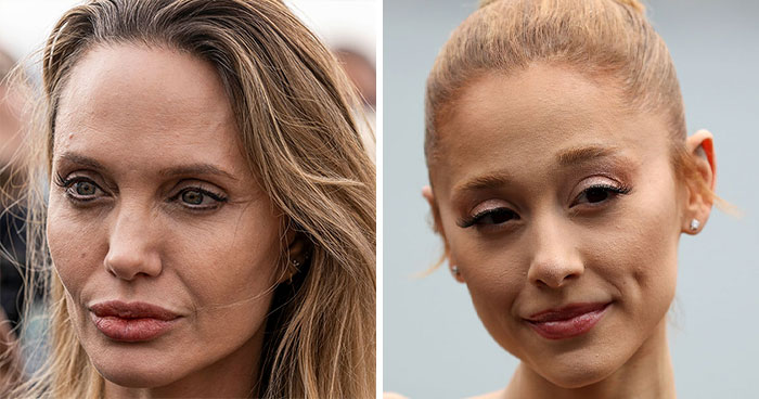 Wait, Celebs Showed Their Real Skin?! Here’s 50+ Close-Ups Proving They’re Just Like Us