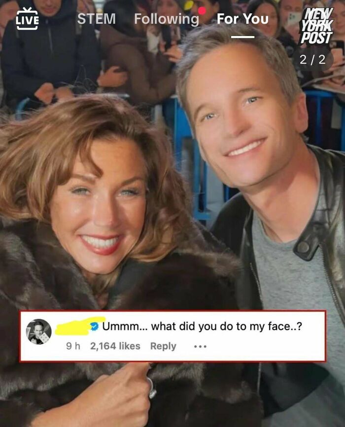 "Ummm... What Happened To My Face?"