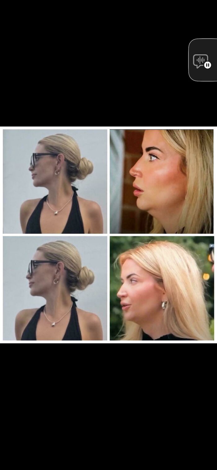 This “Body Positive” Influencer’s TV vs. Insta Glow-Up