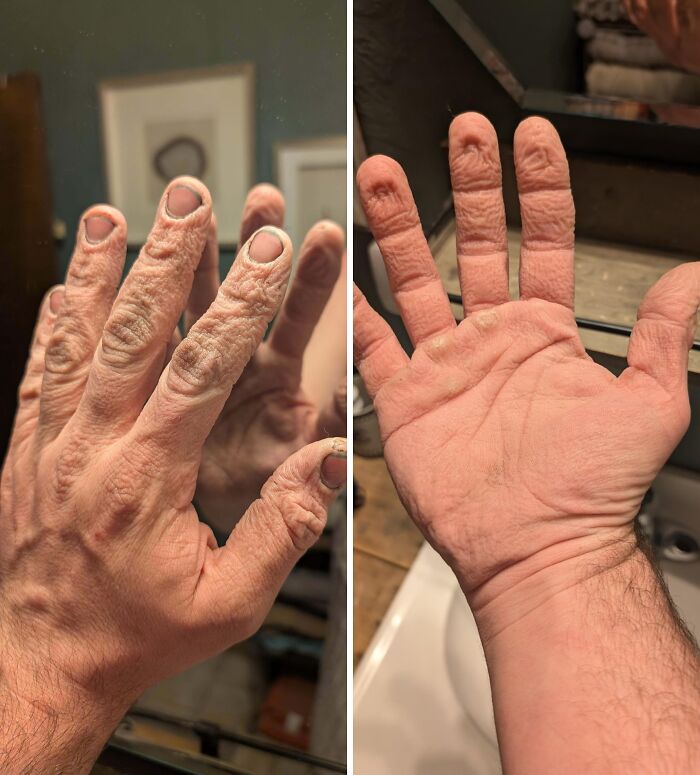 Friendly Reminder: Wear Your Gloves When Handling Brake Fluid!