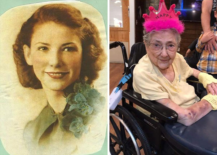 The Woman Who Lived 99 Years With Organs Flipped Like a Mirror