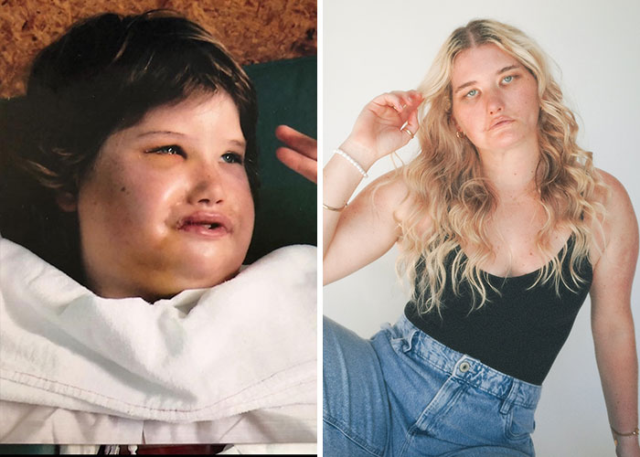 The Model Who Can’t Smile (But Looks Amazing Anyway)