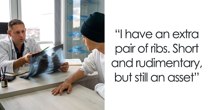 Wait, People Found These Wild Body Surprises Just By Going To The Doctor?