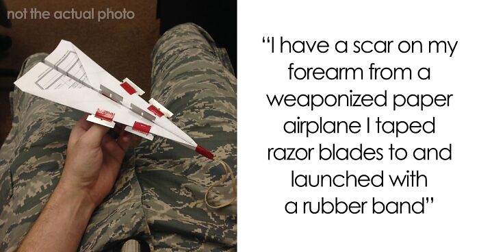 Oops! The 47 Goofiest Scar Stories That’ll Make You Laugh and Cringe