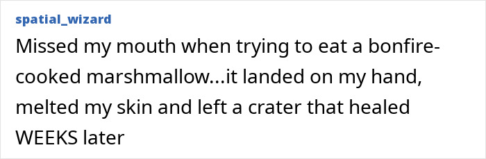 Oops! The 47 Goofiest Scar Stories That’ll Make You Laugh and Cringe