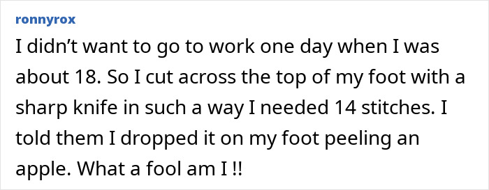 Oops! The 47 Goofiest Scar Stories That’ll Make You Laugh and Cringe