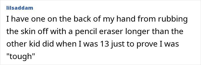 Oops! The 47 Goofiest Scar Stories That’ll Make You Laugh and Cringe