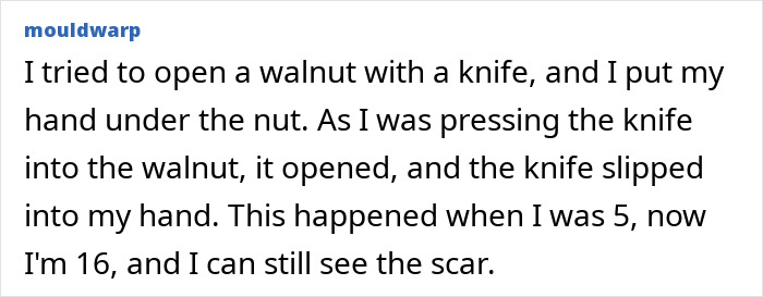 Oops! The 47 Goofiest Scar Stories That’ll Make You Laugh and Cringe