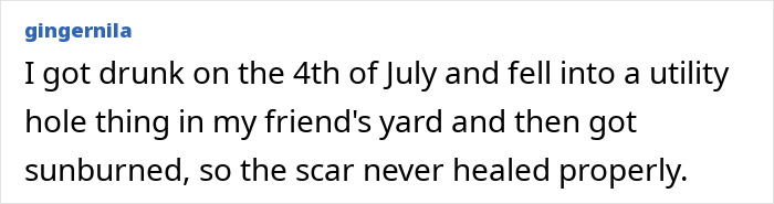 Oops! The 47 Goofiest Scar Stories That’ll Make You Laugh and Cringe