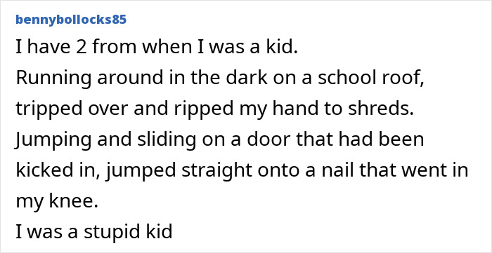 Oops! The 47 Goofiest Scar Stories That’ll Make You Laugh and Cringe