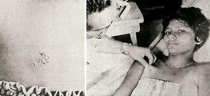 Girl Hit By a Red Laser Beam UFO, Left Unable To Walk or Talk for Weeks