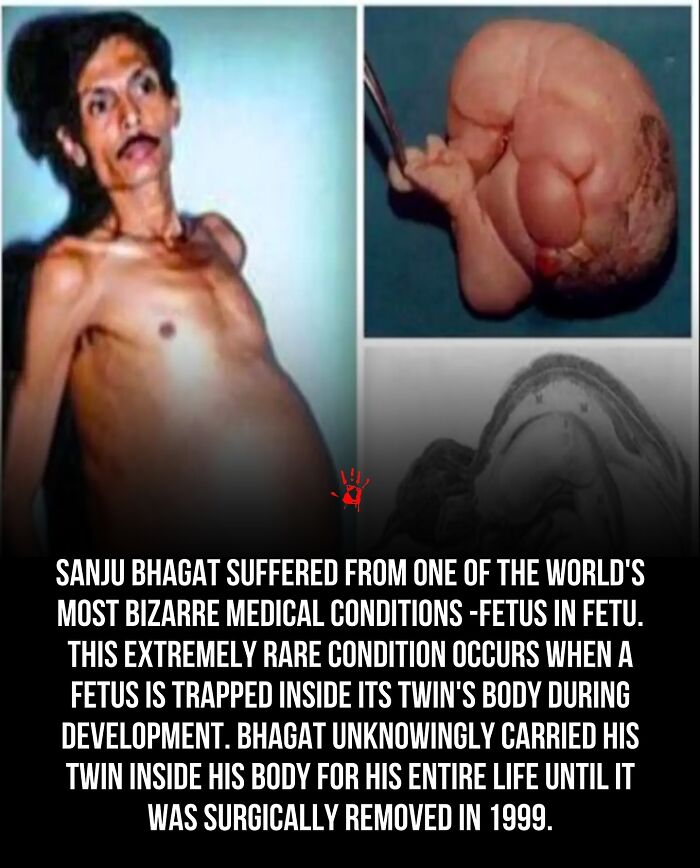 Wait, They Actually Ranked These Morbid Masterpieces?!