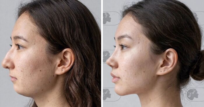 Wait Till You See These Wild Before-And-Afters From a Plastic Surgeon Who Went Viral!