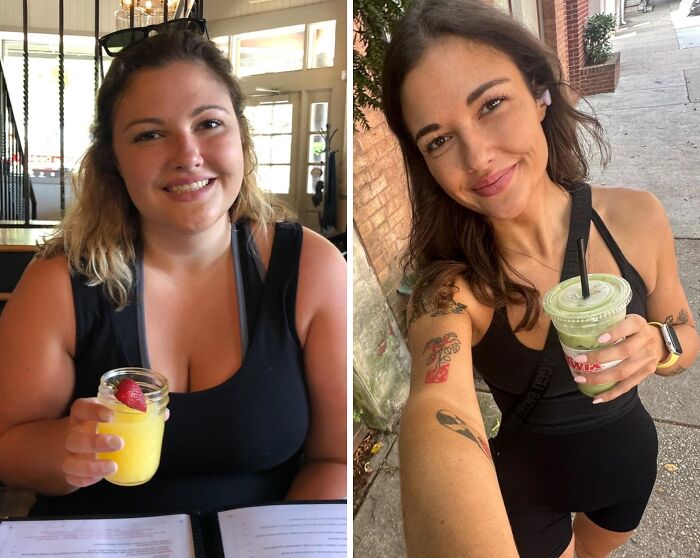 138 Lbs Lost, Skin Surgery In 2 Weeks—Glow-Up In Progress