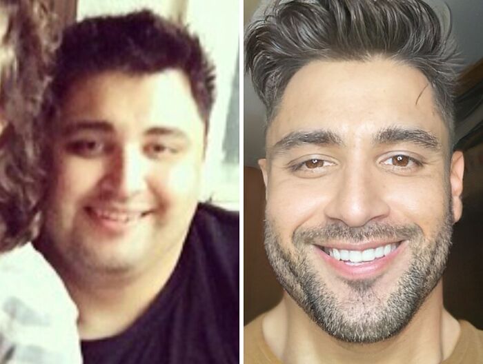 Lost 120 Lbs, Went From Fake to Real Smiles—Hello, Happy Me!