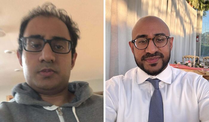 From Stressed and Balding To Healthy and Happy