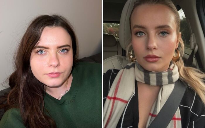 Lip Filler, Botox, Weight Loss, And Hair Color—Glow-Up Remix