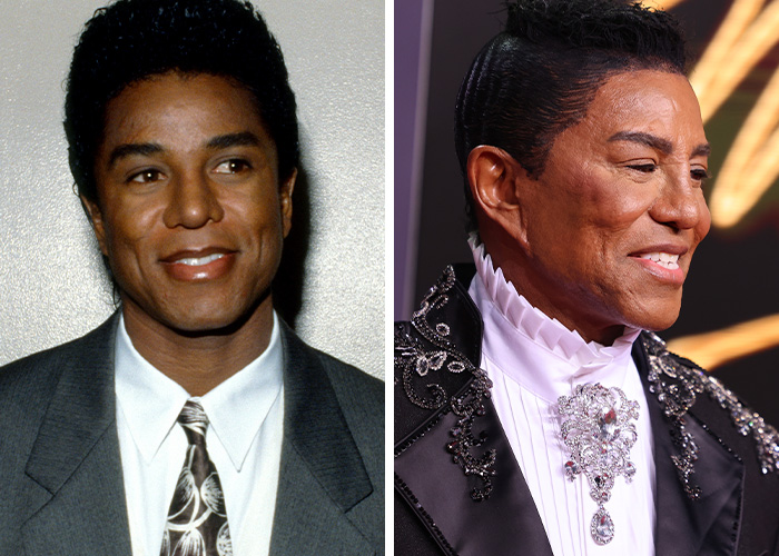 Jermaine Jackson’s Face: Tight, Smooth, and Mysterious