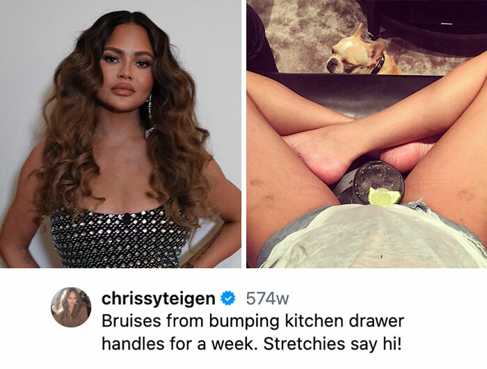 Chrissy Teigen’s No-BS Body Vibes