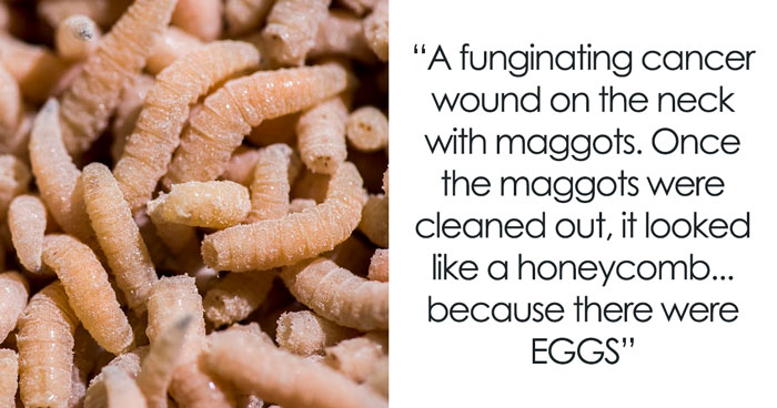 The 28 Wildest Gross-Out Moments Medical Pros Wish They Could Forget
