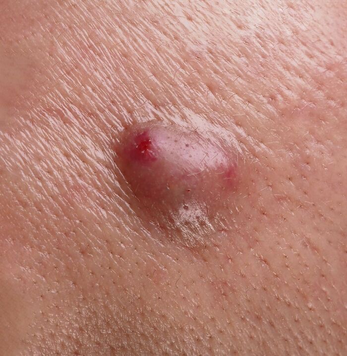 The 28 Wildest Gross-Out Moments Medical Pros Wish They Could Forget