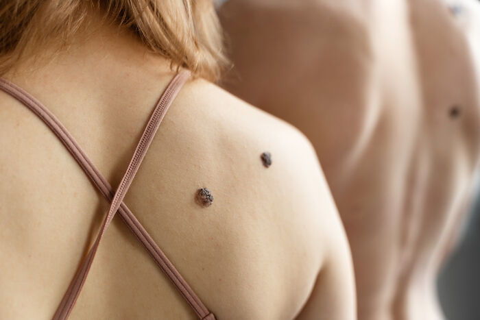 The 28 Wildest Gross-Out Moments Medical Pros Wish They Could Forget