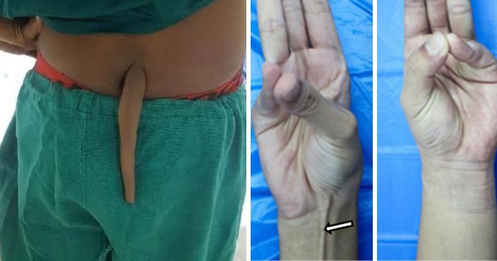 Wait, You Didn’t Know Your Body Does This Stuff?! 14 Weird Human Quirks That’ll Blow Your Mind