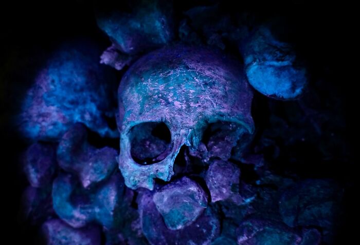 Glow-Up Bones (Literally!)