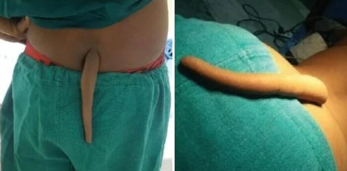 That Tailbone Story